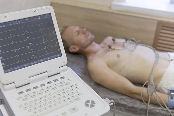 Wann wird eine EKG-Untersuchung durchgeführt?